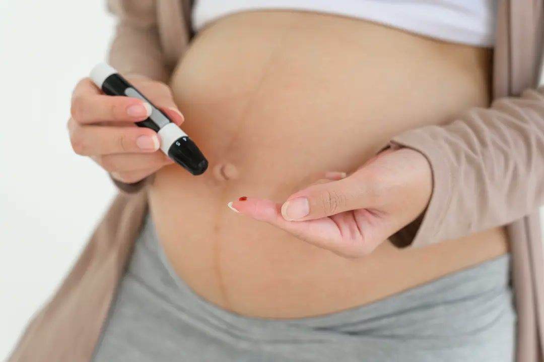 Nėščiųjų (gestacinis) diabetas: rizikos veiksniai, kontrolė ir komplikacijų prevencija